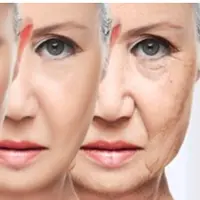 Лифтинг метод: Стань моложе на 10 лет