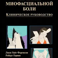 Лечение миофасциальной боли