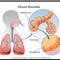 Профилактика ОРЗ