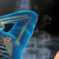 Скажем нет хирургии! Устраним проблемы без нее