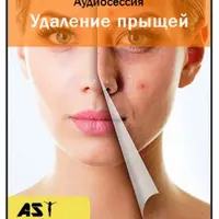 Удаление прыщей