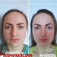 Реанимация. Базовый курс по омоложению лица