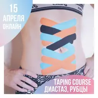 Тейпирование рубцов, шрамов, диастаза и пупочной грыжи