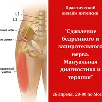 Сдавление бедренного и запирательного нерва