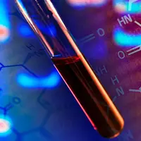 Анализируя анализы. Как по анализам крови выявить проблемы со здоровьем и исправить их нутрицевтиками