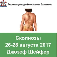 Сколиозы