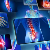 Перезагрузка: Суставы