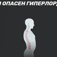 Здоровая спина при гиперлордозе