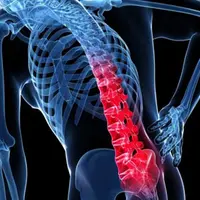 Осанка и боль в спине. Обучающий марафон для тренеров