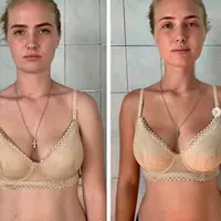 Восстановление молодости лица 2.0