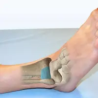 Лечение патологии голеностопного сустава. Онлайн-практикум