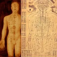 Плече-лопаточный периартрит