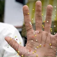 Рассеянный склероз