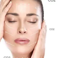 Карбокситерапия