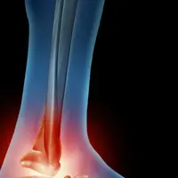 Исцеление лодыжки