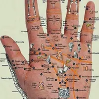 Вегетососудистая дистония