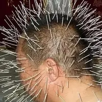 Дизурия у мужчин и женщин