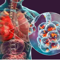 Исцеление от пневмонии Powerful Plus + 11x (Extra Strong)