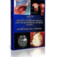 Кисты: головного мозга, яичников, печени, почек. Комплексное лечение