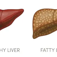 Заживление и регенерация жировой ткани печени