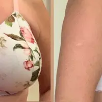 Марафон "Бралетт для большой груди"