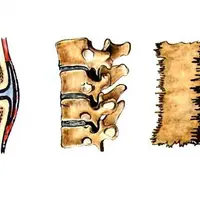 Соединения костей