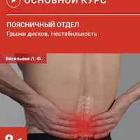 Нестабильность поясничного отдела позвоночника. Грыжи дисков