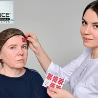 Кросс и Аку тейпирование лица