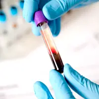 Как разобраться в анализах без помощи врача. Самодиагностика здоровья