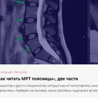 Как читать МРТ поясницы