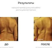 Информационные болезни позвоночника