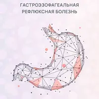 ГЭРБ: Гастроэзофагеальная рефлюксная болезнь