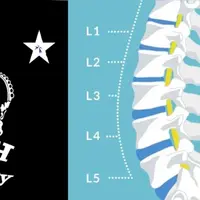 Исцеление и восстановление поясничного отдела