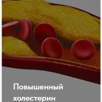 Лечебный протокол "Повышенный холестерин"