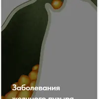 Лечебный протокол "Заболевания желчного пузыря"