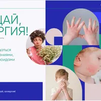 Прощай аллергия