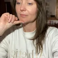 Дисплазия соединительной ткани