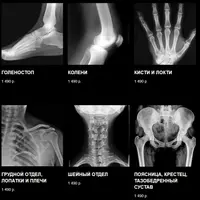 Полный ЛФК курс