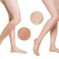 Секреты здоровых ног