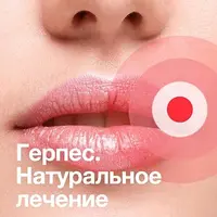 Герпес. Натуральное лечение
