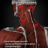 Массаж триггерных точек в шее и голове