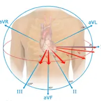 Кардиология