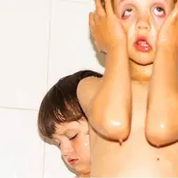 Вспышка в лоб