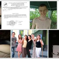 Ревматоидный артрит и аутоиммунные заболевания