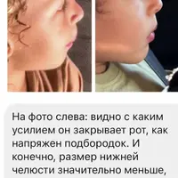 Гайд по миофасциальной коррекции "Создавая лица"