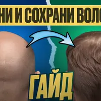 Гайд по рутине против мужского облысения (АГА)