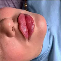 Увеличение губ по технике Аиды Гаруновой