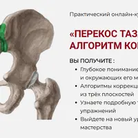 Перекос таза: Пошаговый алгоритм коррекции в 3D