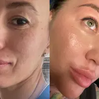 Гормон роста – гормон жиросжигания и кожи без морщин