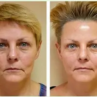 Ключ к молодости